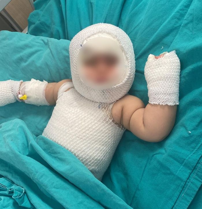 Mersin'de patlayan domates konservesi 9 ayl�k bebe�i yakt�