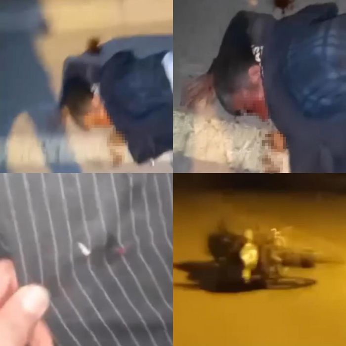 Dvp baklad, yaraly videoya ekip yaptklarn anlatt